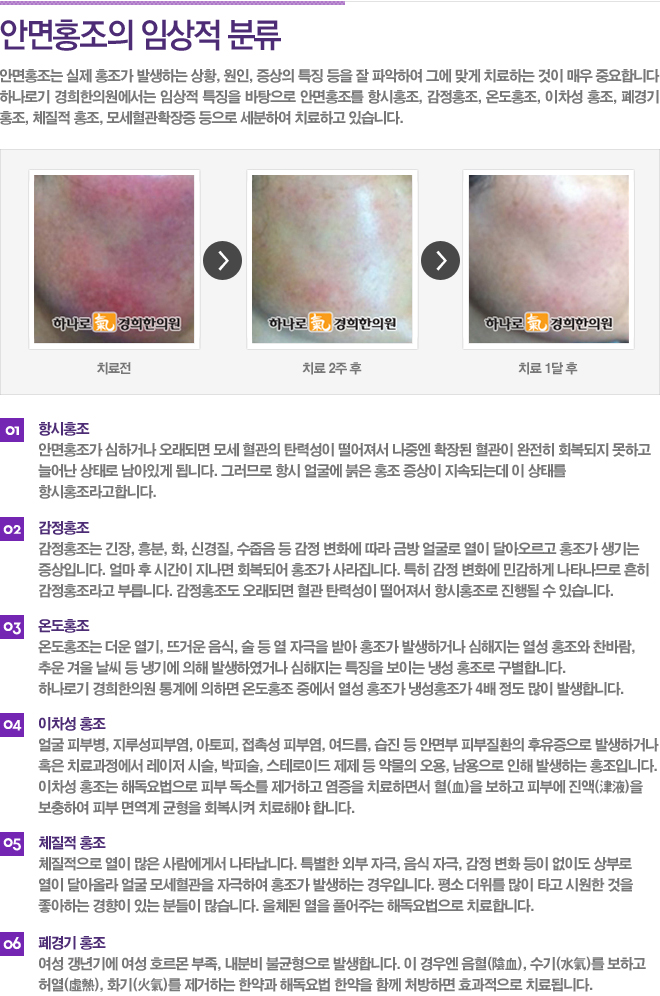 인천안면홍조한의원 오래 지속된다면